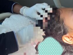 Istri Didorong Hingga Jatuh, Seorang Pria di Besuki Tega Aniaya Dua Perempuan