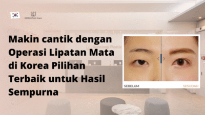 Makin cantik dengan Operasi Lipatan Mata di Korea Pilihan Terbaik untuk Hasil Sempurna